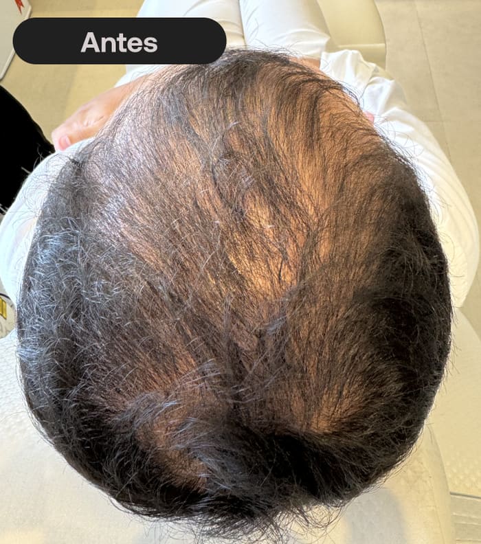 Antes do tratamento